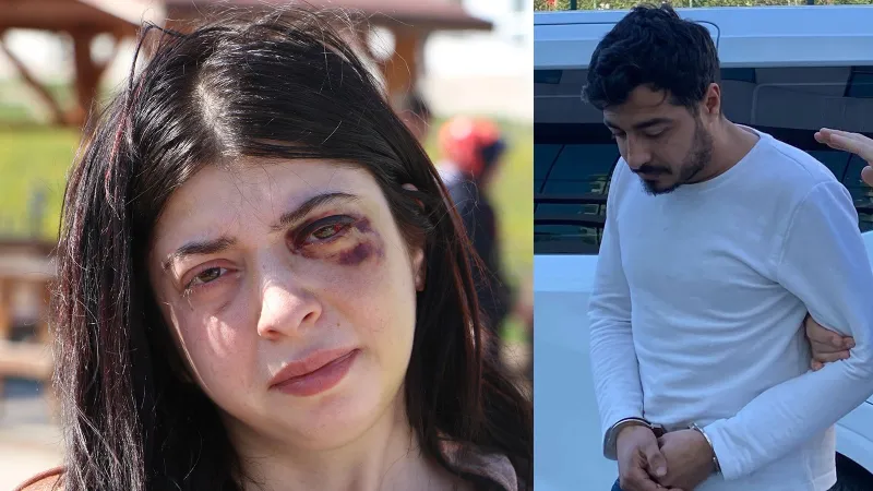 Damla'ya Şok! Dövüp Taciz Eden Saldırgan Serbest mi Bırakıldı?