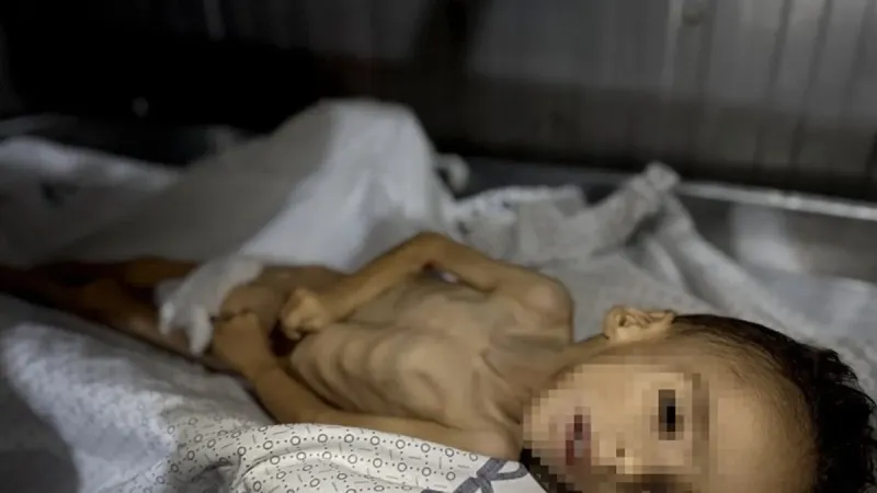 İsrail'in yol açtığı kıtlık nedeniyle Gazze'de 5 yaşındaki çocuk açlıktan yaşamını yitirdi