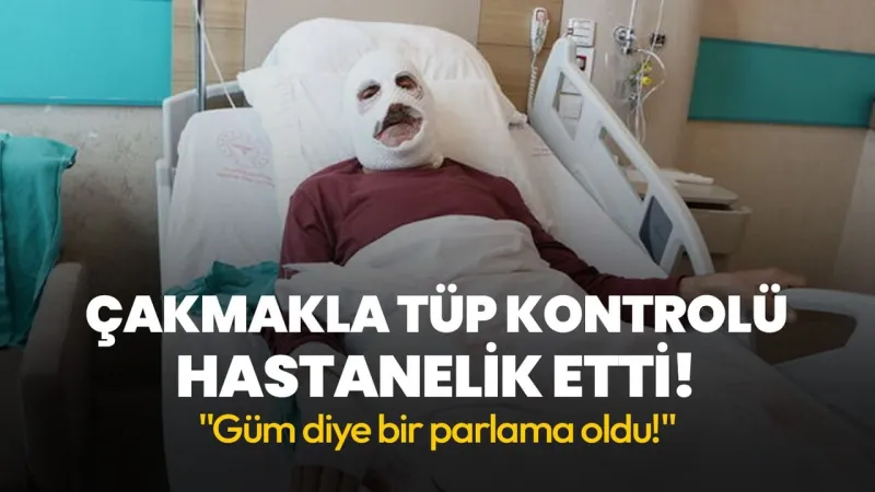 Tüpü Çakmakla Kontrol Etti! Sonrası Facia Oldu!