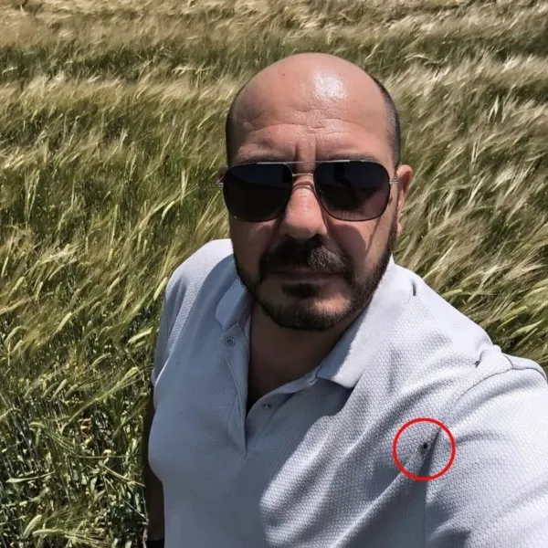 Selfie Hayat Kurtardı! Amasya'da Kene Faciası Önledi